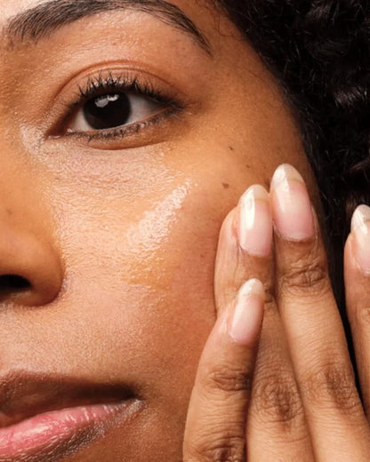 The Ordinary Niacinamide 10% + Zinc 1%, Smoothing Serum for Blemish-Prone Skin